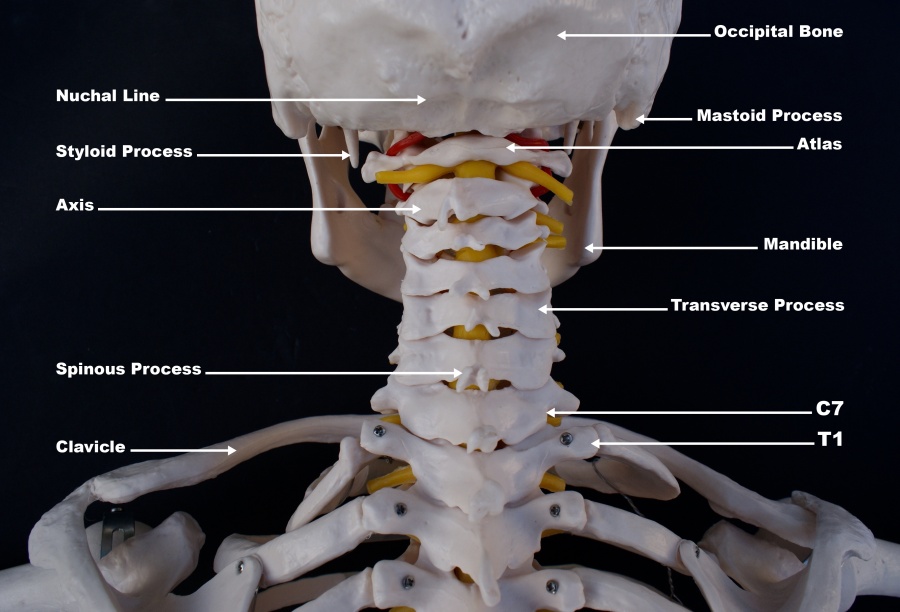 occiptal atlast axis craniovertebral anatomy.jpg